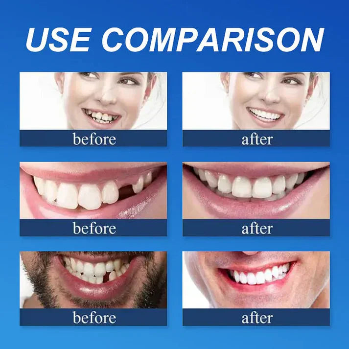 Ends Today: 70% OFF Fresh Smile, Better Fit