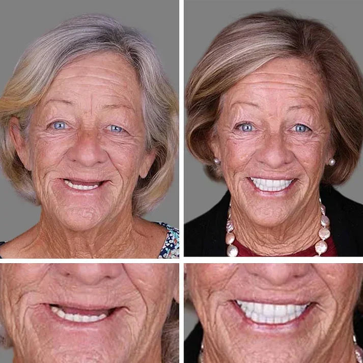 Ends Today: 70% OFF Fresh Smile, Better Fit