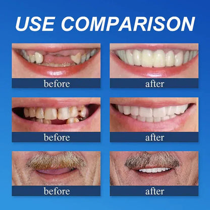 Ends Today: 70% OFF Fresh Smile, Better Fit